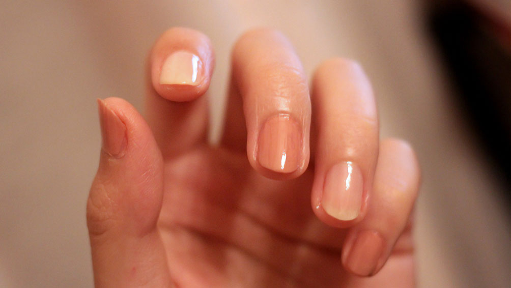 爪を見ると健康状態がわかる！